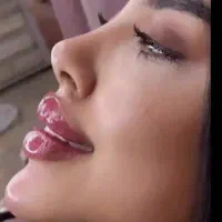 مزونیدلینگ ژل و بوتاکس|خدمات آرایشگری و زیبایی|یاسوج, |دیوار