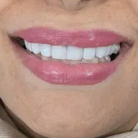 خدمات دندانپزشکی با قیمت مناسب|خدمات آرایشگری و زیبایی|گنبد کاووس, |دیوار