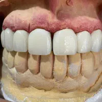 لابراتوار دندانسازی|خدمات آرایشگری و زیبایی|تبریز, |دیوار
