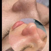 پاکسازی صورت با مواد کاملا گیاهی