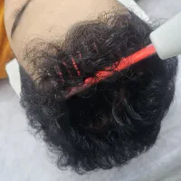 مزوتراپی مو ، ابرو ، جوانسازی ، فیشیال ، پاکسازی|خدمات آرایشگری و زیبایی|کرج, جهان‌شهر|دیوار