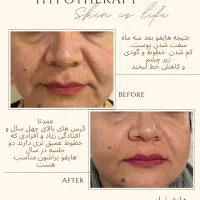 خدمات زیبایی کلینیک فارا دامغان|خدمات آرایشگری و زیبایی|دامغان, |دیوار