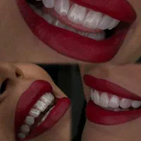 کامپوزیت دندان لیانا همراه با شرایط