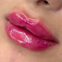 ژل وبوتاکس اف بهاره