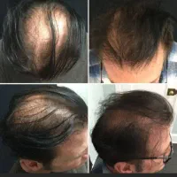 پنج هزار نفر راضی