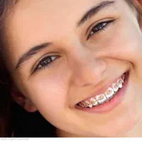 دندانپزشکی ارتودنسی دندان زیبایی صورت|خدمات آرایشگری و زیبایی|مشهد, جنت|دیوار