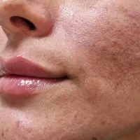 مرکز زیبایی