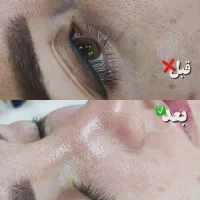 تخفیف ویژه فشیال، میکاپ و لیفت مژه