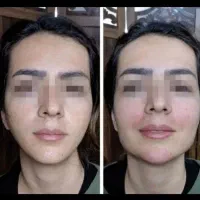 خدمات ژل وبوتاکس /کاشت مووابرو/باکمترین قیمت|خدمات آرایشگری و زیبایی|خرم‌آباد, |دیوار