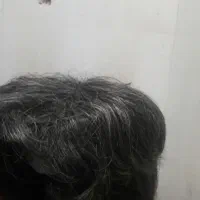 کلاه گیس مردانه|آرایشی، بهداشتی، درمانی|نظرآباد, شهرک صنعتی سپهر|دیوار