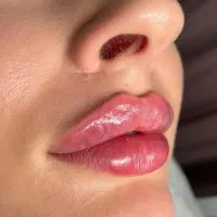 مطب پوست،لیزر بیماری‌ داخلی پوست دکتر رادمند