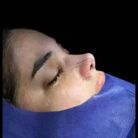 جشنواره عمل بینی|خدمات آرایشگری و زیبایی|ری, علایین|دیوار