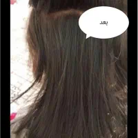 درمان قطعی رشک و شپش با ضمانت|آرایشی، بهداشتی، درمانی|سبزوار, امیر کبیر|دیوار