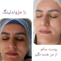 لیزرکیوسوییچ وایتینینگ پاکسازی هالیوودی سفید کننده|خدمات آرایشگری و زیبایی|اسلام‌شهر, زرافشان|دیوار