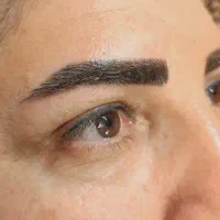انجام خدمات میکروبلیدینگ ومیکرو پیگمنتیشن