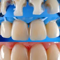 ویژه کارمندان پرداخت آسان چک صیادی تخفیف ویژه|خدمات آرایشگری و زیبایی|قم, زنبیل آباد|دیوار