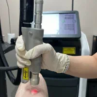 لیزرموهای زائد الکس (شاتی) جشنواره ویژه