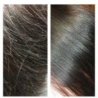 موخوره گیری