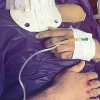 خدمات تزریقات و مراقبت های پرستاری در منزل