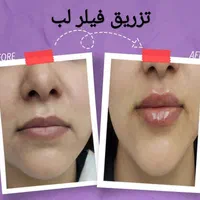 خدمات زیبایی جامع با بهترین کیفیت|خدمات آرایشگری و زیبایی|اصفهان, شاهزاده ابراهیم|دیوار