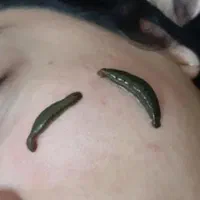 چکاپ کلی خدمات زیبایی طب سنتی حجامت زالو بادکش فصد