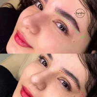 میکرو فیبروز کاورتتو قدیمی یک ساعت بعدبشور گارانتی