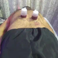 حجامت درمانی فیزیوتراپی وروغن و بادکش ورزشی|خدمات آرایشگری و زیبایی|اندیمشک, |دیوار