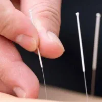 طب سوزنی،کایروپراکتیک،اعمال یداوی.