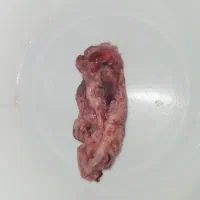 درمان قطعی و تضمینی