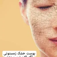 کرم جوانساز و لکه بر صابون ضد جوش  ژل  حلزون