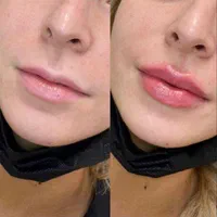 تخفیف ویژه ژل و بوتاکس شیدینگ لب و بن مژه و پرسینگ|خدمات آرایشگری و زیبایی|مشهد, توس (بلوار توس)|دیوار