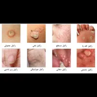 درمان از ریشه