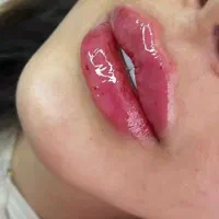 جشنواره ژل و بوتاکس فقط ۳۹۰ تومان|خدمات آرایشگری و زیبایی|شیراز, انجیر|دیوار