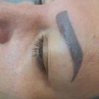 رایگان تزریق انزیم همراه با پلکسر پلک و چروک