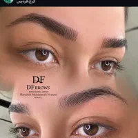 میکروبلیدینگ،شیدینگ لب، بن مژه و خط چشم