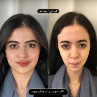 کرم سفید کننده صورت و بدن 10درجه سفیدی دائم|آرایشی، بهداشتی، درمانی|کرمان, |دیوار