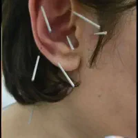 طب سنتی ،ماساژ، رفع خر و پف درمان تضمینی میگرن