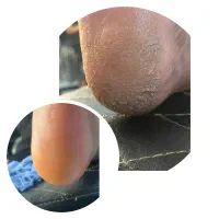 پاکسازی صورت/پدیکورپا/پارافین(اموزش هم داده میشود)|خدمات آرایشگری و زیبایی|اهواز, کوی علوی|دیوار