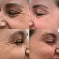 تخفیف لیزر موهای زائد تا آخر هفته  ۳۹۰ تومان|خدمات آرایشگری و زیبایی|کرج, گوهردشت|دیوار