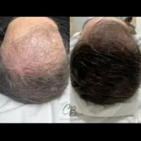راهکار نوین افزایش حجم