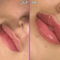 ژل لب فقط ۳۸۰|خدمات آرایشگری و زیبایی|شیراز, شهرک فرهنگیان|دیوار