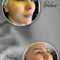 درمان پوست باتخفیف بلک فرایدی/پوست کره‌ای/کاموفلاژ|خدمات آرایشگری و زیبایی|پاکدشت, پاکدشت (مامازند)|دیوار