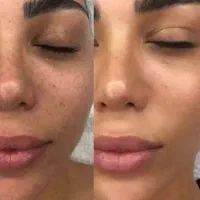 کرم بیوممتیک اورجینال جوانساز