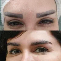 حراج با کمترین قیمت بهترین مواد پاک کننده
