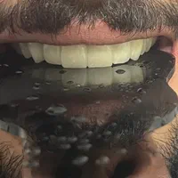 دندان سازی|خدمات آرایشگری و زیبایی|خوی, |دیوار