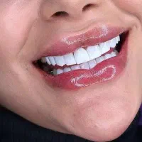 دندانپزشکی و ایمپلنت و کامپوزیت و ارتودنسی|خدمات آرایشگری و زیبایی|سرپل ذهاب, |دیوار