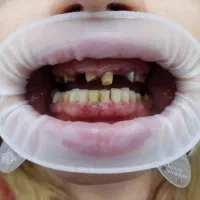لابراتوار دندانپزشکی (سازنده انواع روکش 2500ت)