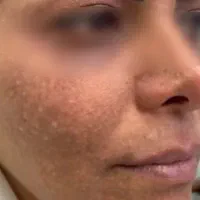 اماراتی ضدلک ترکیبی