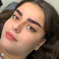 تخفیفات یلدایی میکروبلیدینگ و شیدینگ لب شهرک سعدی