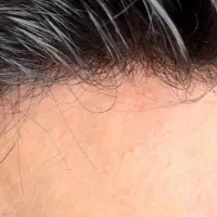 حراج و جشنواره بزرگ پروتز و ریموور و چسب مو|حراج|شیراز, بعثت|دیوار